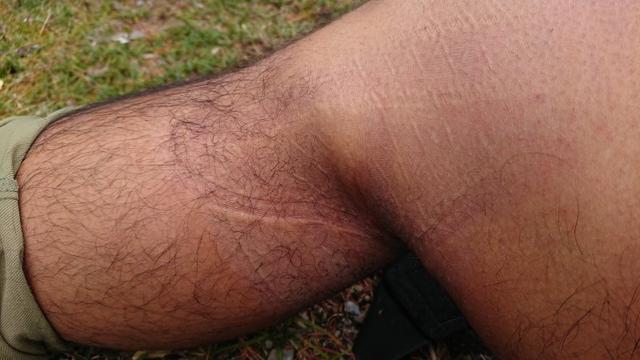 且行且珍惜,美國運動護具品牌LP護膝評測