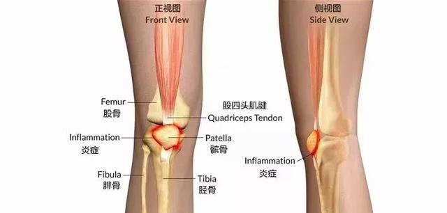 戶外爬山一定需要護膝嗎？戶外運動護膝到底有用嗎？