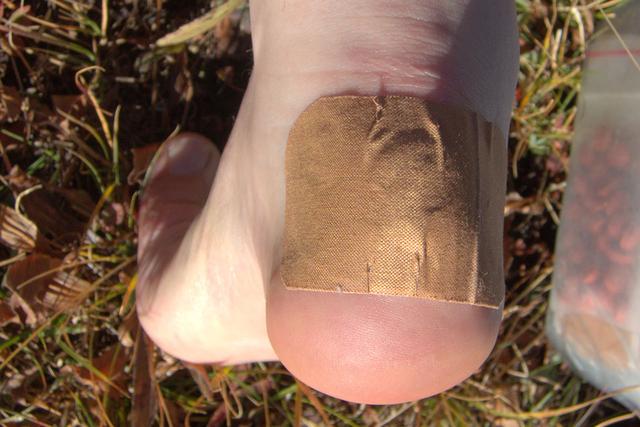 腳上起泡怎么辦,徒步愛好者必看怎樣預防和處理腳上起泡