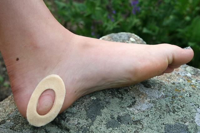 腳上起泡怎么辦,徒步愛好者必看怎樣預防和處理腳上起泡