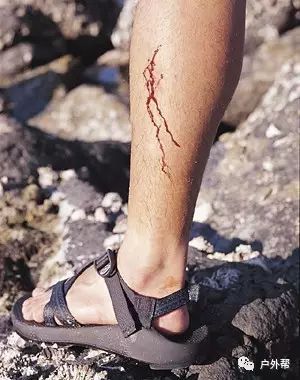 2dc00f9c51f5417b8ceccc5c41221322 2dc00f9c51f5417b8ceccc5c41221322